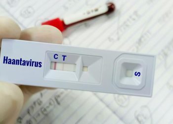 Warga Kulon Progo yang Suspek Virus Hanta Dinyatakan Negatif