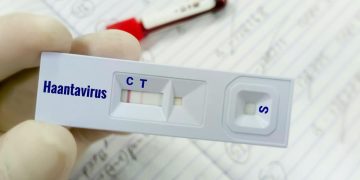 Warga Kulon Progo yang Suspek Virus Hanta Dinyatakan Negatif
