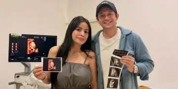 Andrew Andika Sambut Kelahiran Anak Perempuan dan Alasan Pilih Operasi Caesar