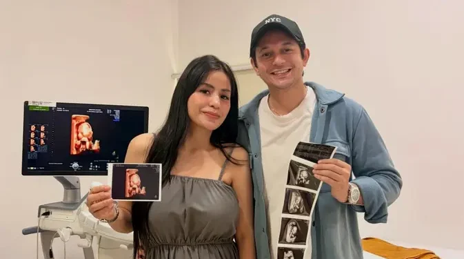 Andrew Andika Sambut Kelahiran Anak Perempuan dan Alasan Pilih Operasi Caesar