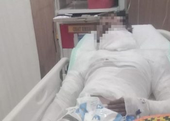 Sopir Truk Bali yang Dibakar Bos Meninggal Dunia Setelah Seminggu Kritis