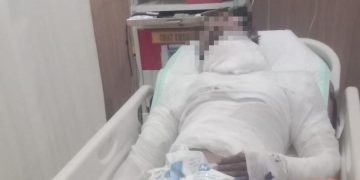 Sopir Truk Bali yang Dibakar Bos Meninggal Dunia Setelah Seminggu Kritis
